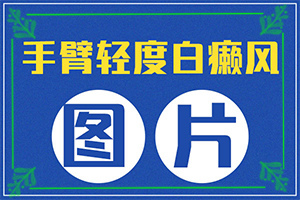 眼內(nèi)角白斑是怎么回事[何種原因呢]