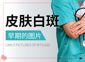 長白殿風是什么原因-男生私密處出現(xiàn)白斑是怎么回事