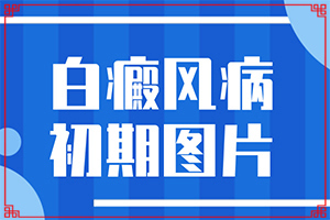 白瘋病是怎么引起的-兒童胳膊白斑是什么原因引起的