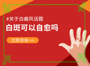 白癲瘋能根治嗎[如何治療]兒童白點癲風(fēng)可以治好嗎