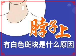 白癩風(fēng)由什么引起的,病因有什么(幾大病因是什么)