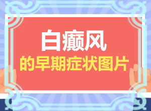 白巔峰初期圖片(如何正確區(qū)分)-白點(diǎn)初期癥狀