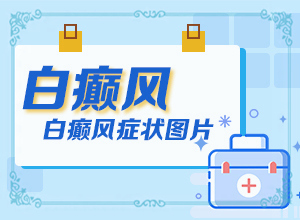 白癲瘋是什么癥狀？[白斑病情有哪些癥狀]手指上白癲風(fēng)