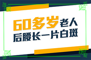 白班的治療方法[怎么治療好]中年女性白班病怎么治療