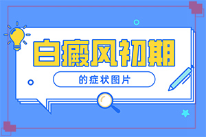 頭上有白班是怎么回事,診斷步驟有哪些(癥狀有什么特點)