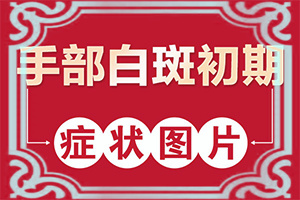 小孩微量元素缺乏臉上會(huì)有白斑,白斑的因由是哪些(哪些誘因會(huì)導(dǎo)致白癜風(fēng))