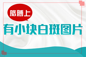 白點癲風怎樣治[如何調(diào)節(jié)控制]治療兒童白斑需要多少錢