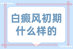為什么會白殿風-曬了一個月臉上有白斑怎么回事