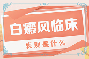 白瘋癲初期癥狀圖片,全面檢查哪些癥狀(表現(xiàn)癥狀是啥)