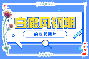 輕微白癩風圖片,又有哪些癥狀表現(xiàn)呢(如何區(qū)分)