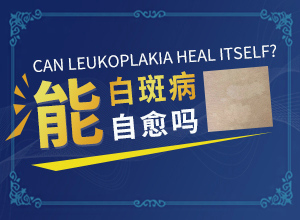 白顛風(fēng)能治好嗎[治療有什么好處]遺傳白巔峰治療法