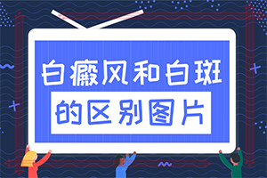 白點(diǎn)癲風(fēng)由什么引起的-小孩子濕氣重面部會(huì)出現(xiàn)白斑嗎