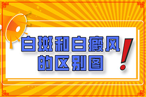 白點(diǎn)癲風(fēng)初期能治好嗎-[區(qū)別圖]做好這些即可