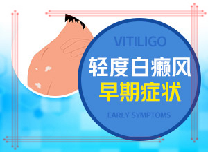 好的白斑病醫(yī)院是哪家,需要怎樣的治療(應(yīng)該做些什么)