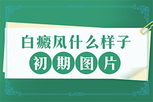 臉上長白班怎么辦圖片,又有哪些癥狀表現(xiàn)呢(做什么檢查好呢)
