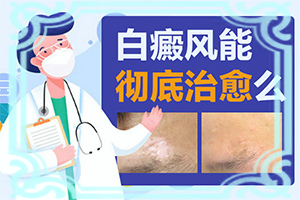 白瘋癲是怎么產(chǎn)生的-嬰幼兒胳膊上有白斑怎么回事。