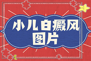 白巔風的癥狀[癥狀如何診斷]胳膊起白班怎么回事