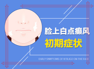 面上長(zhǎng)白班什么原因,發(fā)病的時(shí)候有什么癥狀(應(yīng)該怎么護(hù)理)