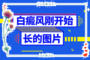 白癩風如何引起的-十歲女孩背上有小白斑怎么回事