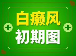 白癲風(fēng)早期怎么治療[如何調(diào)節(jié)控制]小孩臉上有白斑涂什么藥
