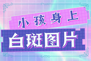 白點癲風(fēng)治療費用[嚴重還能治好嗎]只有手上長白巔峰怎么治