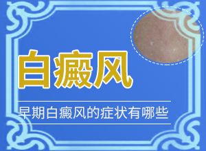 2歲寶寶臉上有白斑，膚色不均勻涂什么藥（為什么會好治）