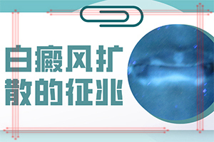 白顛如何治療[可以用什么來治療]治白巔峰的治療方法