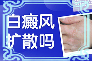 身上出現小白斑塊是怎么回事-誘發(fā)的原因有