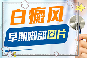 [能做些什么]四肢上的白殿風(fēng)能治好嗎