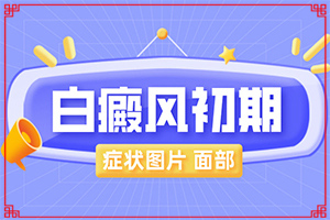 兒童白點(diǎn)癲風(fēng)可以治愈嗎-怎樣控制白斑不擴(kuò)散