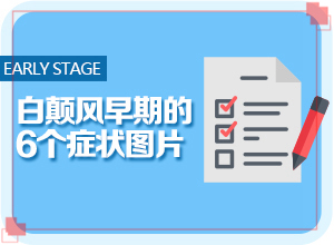 嬰幼兒胳膊上長(zhǎng)白斑是什么原因,白斑誘發(fā)什么有關(guān)(什么原因會(huì)誘導(dǎo)白斑)