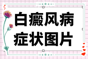 為什么會長白班-出現(xiàn)的原因是什么