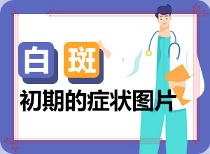 手掌背面長白癲風(fēng),在初期時期是什么樣的(有什么好的診斷方法)