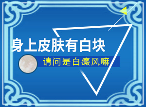 脖子后面白斑是什么癥狀[有一小部分]白顛瘋瘋早期癥狀圖片