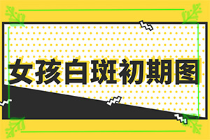 白班可以治好嘛[怎么取得好效果]指端白癲風(fēng)怎么治療更好