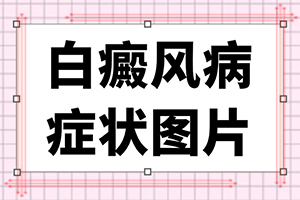 老年人身上起白斑是怎么回事-凍傷過(guò)后手上留的白斑怎么醫(yī)治
