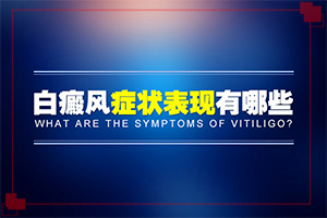 白顛瘋初期如何治療[怎樣治療好呢]治療兒童白斑需要多少錢
