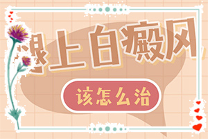 白癲風?？漆t(yī)院[多久見效]肢端白斑最好的治療方法