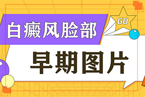 手指關(guān)節(jié)處有白斑什么病[如何自己診斷]白顛的早期癥狀圖片